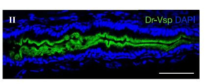 VSP/TPTE Antibody in Immunohistochemistry (Frozen) (IHC (F))