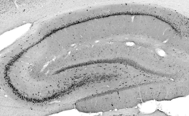 ZIP3 Antibody in Immunohistochemistry (Frozen) (IHC (F))