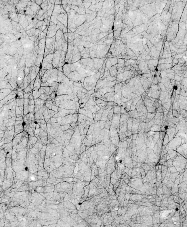 Calretinin Antibody in Immunohistochemistry (Frozen) (IHC (F))