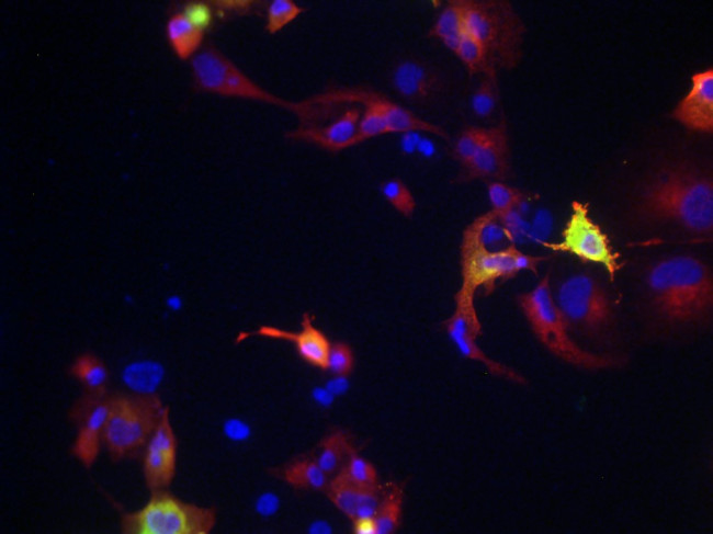Kv6.1 Antibody in Immunocytochemistry (ICC/IF)