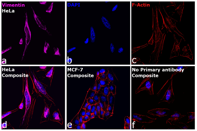 Vimentin  Antibody in Immunocytochemistry (ICC/IF)