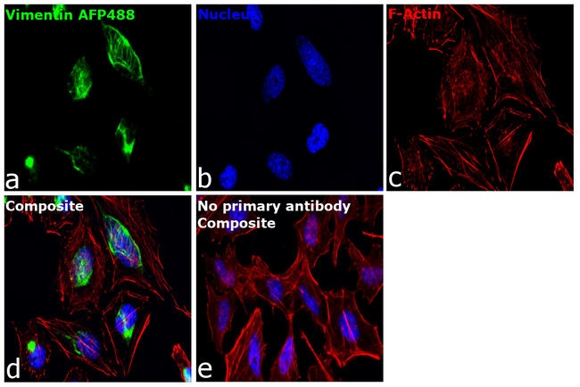 Vimentin Antibody in Immunocytochemistry (ICC/IF)