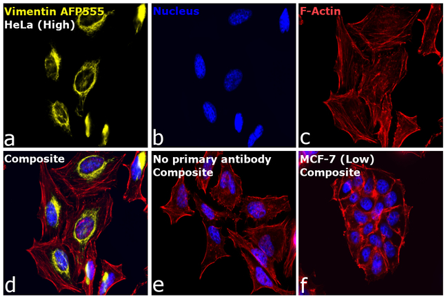 Vimentin Antibody in Immunocytochemistry (ICC/IF)