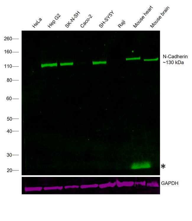 N-Cadherin Antibody in Western Blot (WB)