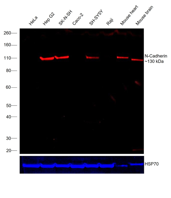 N-Cadherin Antibody in Western Blot (WB)
