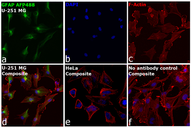 GFAP Antibody in Immunocytochemistry (ICC/IF)