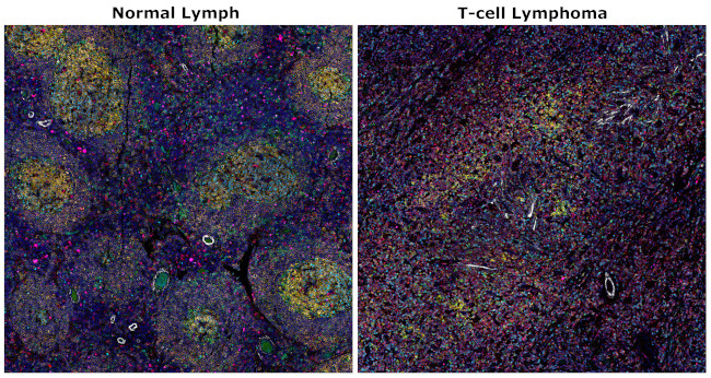 CD8 alpha Antibody in Immunohistochemistry (Paraffin) (IHC (P))