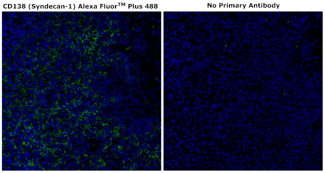 CD138 Antibody in Immunohistochemistry (Paraffin) (IHC (P))