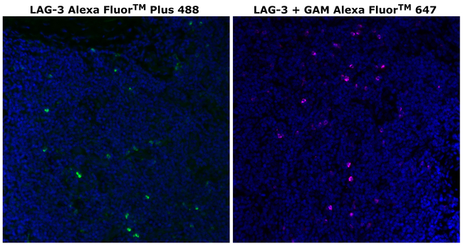 CD223 (LAG-3) Antibody in Immunohistochemistry (Paraffin) (IHC (P))