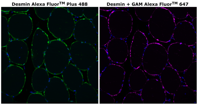 Desmin Antibody in Immunohistochemistry (Paraffin) (IHC (P))