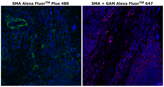 Alpha-Smooth Muscle Actin Antibody in Immunohistochemistry (Paraffin) (IHC (P))