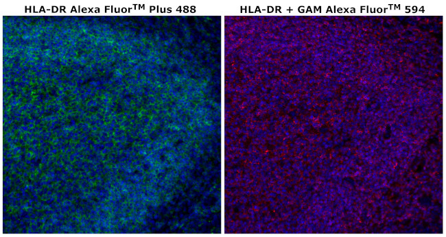 HLA-DR Antibody in Immunohistochemistry (Paraffin) (IHC (P))