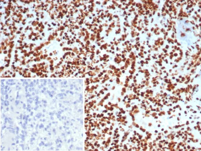 XRCC5 (Ku86/Ku80) (Thyroid-Lupus Autoantigen) Antibody in Immunohistochemistry (Paraffin) (IHC (P))
