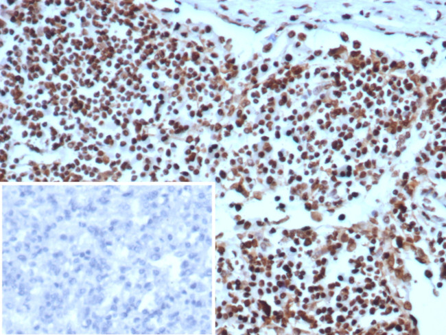 XRCC5 (Ku86/Ku80) (Thyroid-Lupus Autoantigen) Antibody in Immunohistochemistry (Paraffin) (IHC (P))