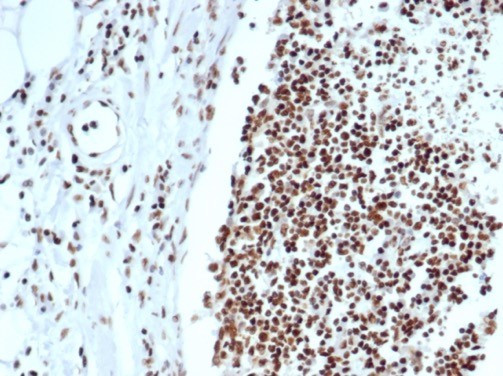 XRCC5 (Ku86/Ku80) (Thyroid-Lupus Autoantigen) Antibody in Immunohistochemistry (Paraffin) (IHC (P))