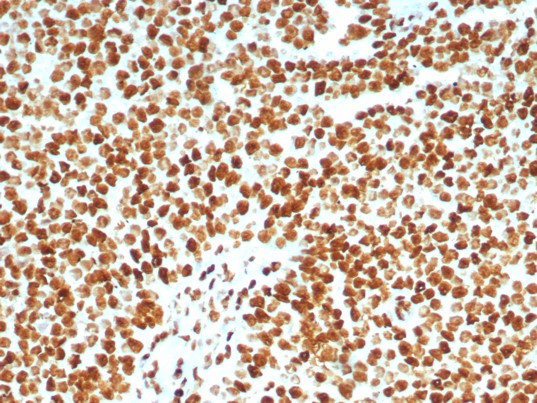 XRCC5 (Ku86/Ku80) (Thyroid-Lupus Autoantigen) Antibody in Immunohistochemistry (Paraffin) (IHC (P))