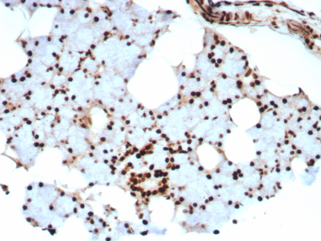 XRCC5 (Ku86/Ku80) (Thyroid-Lupus Autoantigen) Antibody in Immunohistochemistry (Paraffin) (IHC (P))