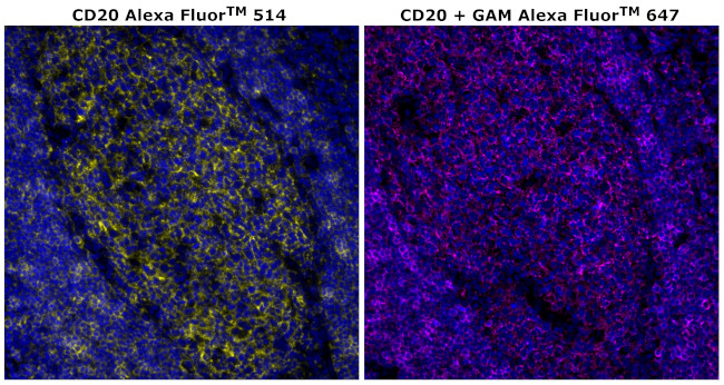 CD20 Antibody in Immunohistochemistry (Paraffin) (IHC (P))