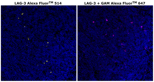 CD223 (LAG-3) Antibody in Immunohistochemistry (Paraffin) (IHC (P))
