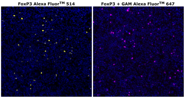 FOXP3 Antibody in Immunohistochemistry (Paraffin) (IHC (P))