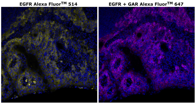 EGFR Antibody in Immunohistochemistry (Paraffin) (IHC (P))