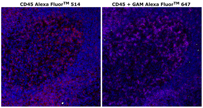 CD45 Antibody in Immunohistochemistry (Paraffin) (IHC (P))