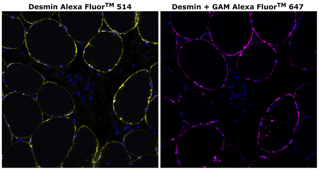 Desmin Antibody in Immunohistochemistry (Paraffin) (IHC (P))