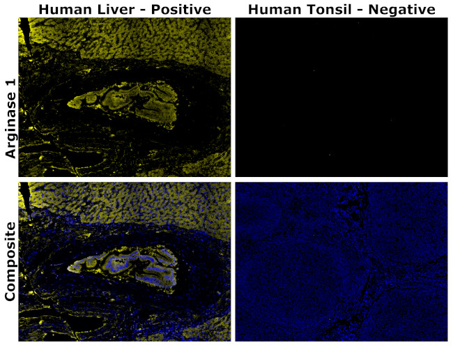 Arginase 1 Antibody in Immunohistochemistry (Paraffin) (IHC (P))