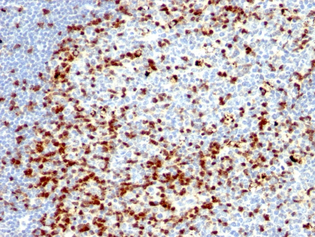 ZAP70 (Chronic Lymphocytic Leukemia Marker) Antibody in Immunohistochemistry (Paraffin) (IHC (P))