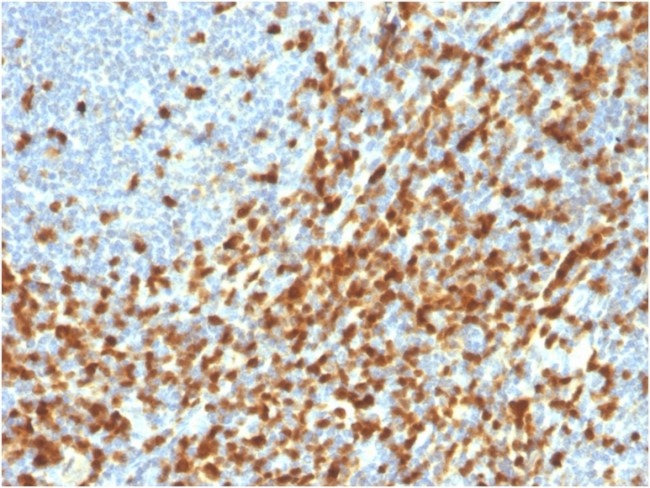 ZAP70 Antibody in Immunohistochemistry (Paraffin) (IHC (P))