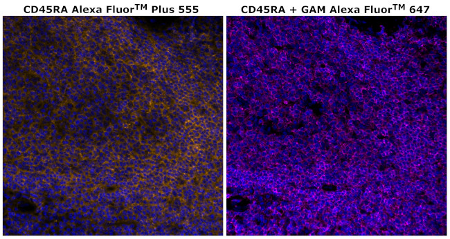 CD45RA Antibody in Immunohistochemistry (Paraffin) (IHC (P))