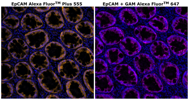 CD326 (EpCAM) Antibody in Immunohistochemistry (Paraffin) (IHC (P))