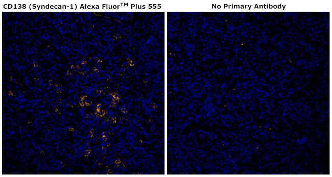 CD138 Antibody in Immunohistochemistry (Paraffin) (IHC (P))