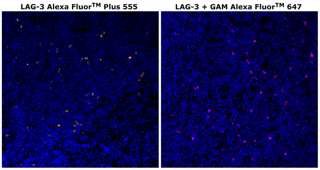 CD223 (LAG-3) Antibody in Immunohistochemistry (Paraffin) (IHC (P))