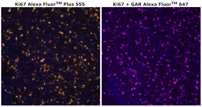 Ki-67 Antibody in Immunohistochemistry (Paraffin) (IHC (P))