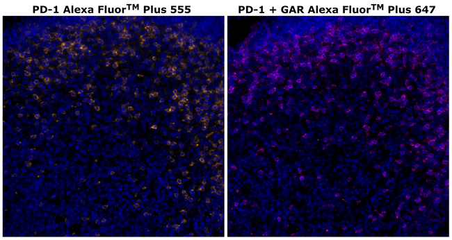 PD-1 (CD279) Antibody in Immunohistochemistry (Paraffin) (IHC (P))