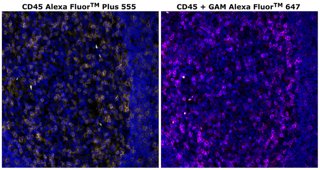 CD45 Antibody in Immunohistochemistry (Paraffin) (IHC (P))