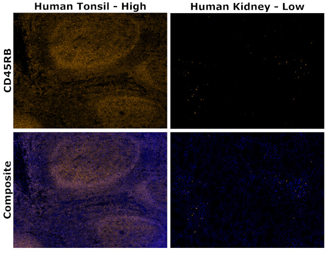 CD45RB Antibody in Immunohistochemistry (Paraffin) (IHC (P))