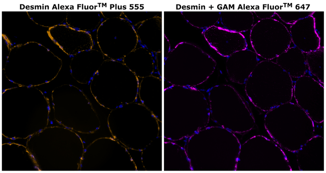 Desmin Antibody in Immunohistochemistry (Paraffin) (IHC (P))