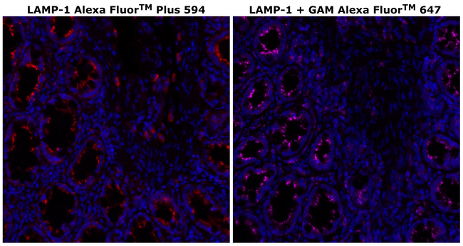CD107a (LAMP-1) Antibody in Immunohistochemistry (Paraffin) (IHC (P))