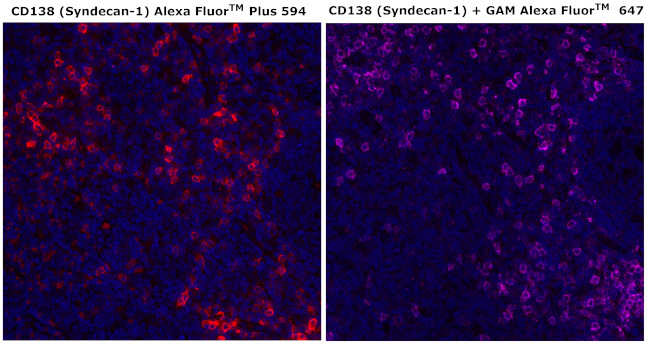 CD138 Antibody in Immunohistochemistry (Paraffin) (IHC (P))