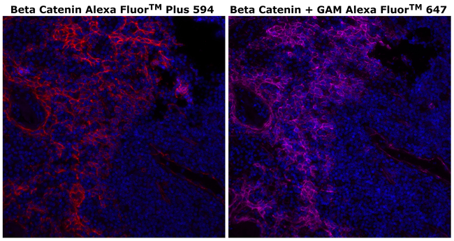 beta Catenin Antibody in Immunohistochemistry (Paraffin) (IHC (P))