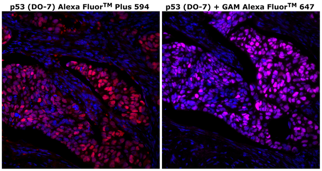 p53 Antibody in Immunohistochemistry (Paraffin) (IHC (P))