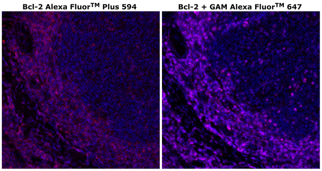 Bcl-2 Antibody in Immunohistochemistry (Paraffin) (IHC (P))