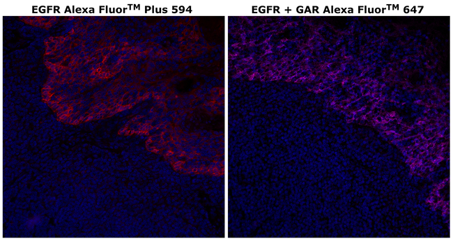 EGFR Antibody in Immunohistochemistry (Paraffin) (IHC (P))