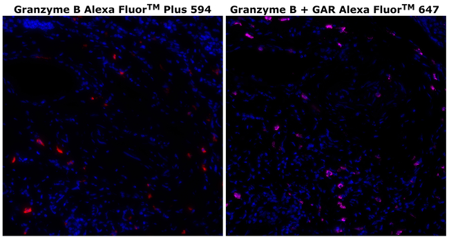 Granzyme B Antibody in Immunohistochemistry (Paraffin) (IHC (P))