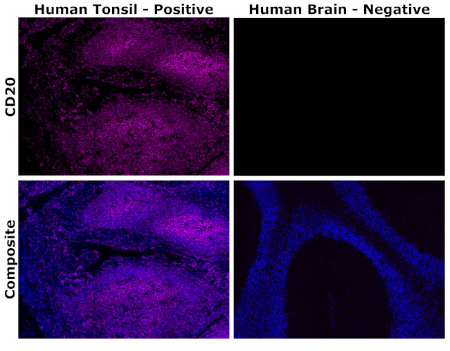 CD20 Antibody in Immunohistochemistry (Paraffin) (IHC (P))