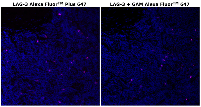 CD223 (LAG-3) Antibody in Immunohistochemistry (Paraffin) (IHC (P))