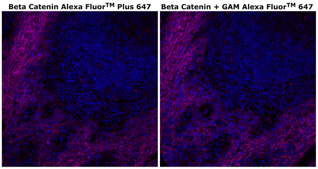 beta Catenin Antibody in Immunohistochemistry (Paraffin) (IHC (P))