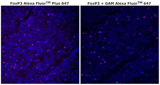 FOXP3 Antibody in Immunohistochemistry (Paraffin) (IHC (P))